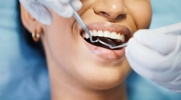 Best After-Hours Dental Trauma Care in South Pekin, IL